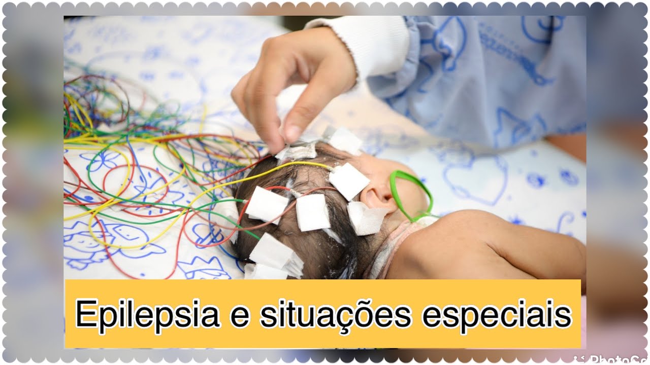 Epilepsia: entenda o que é a doença