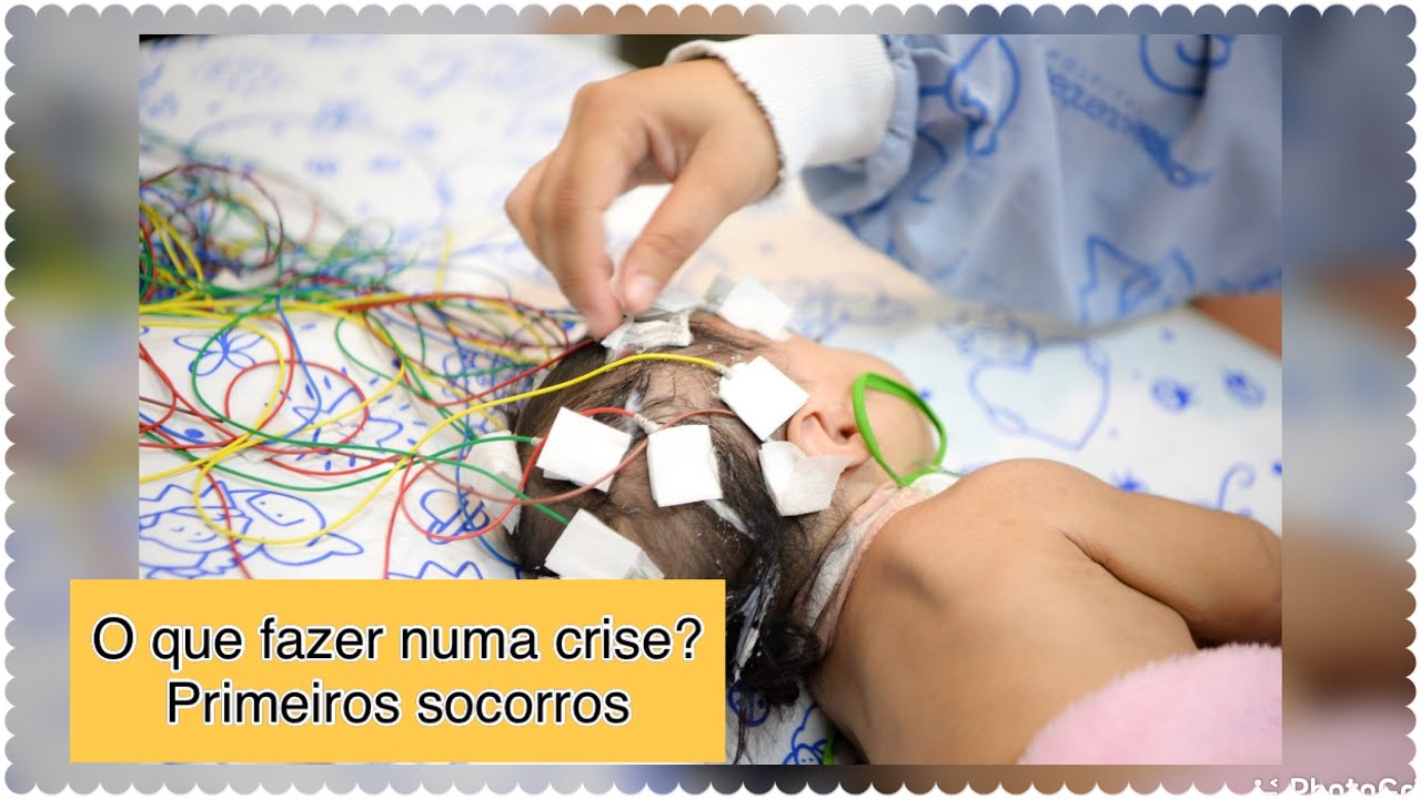 Epilepsia tem tratamento?