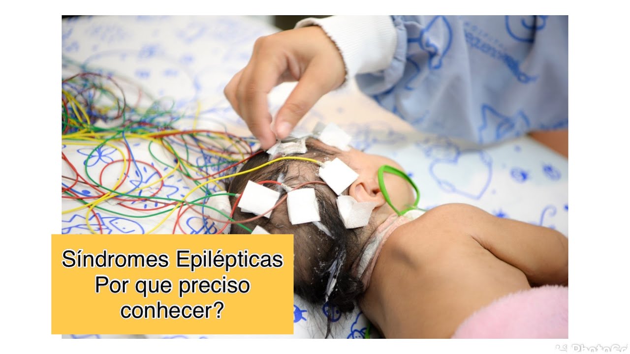 Tipos de crises epilépticas: você conhece?