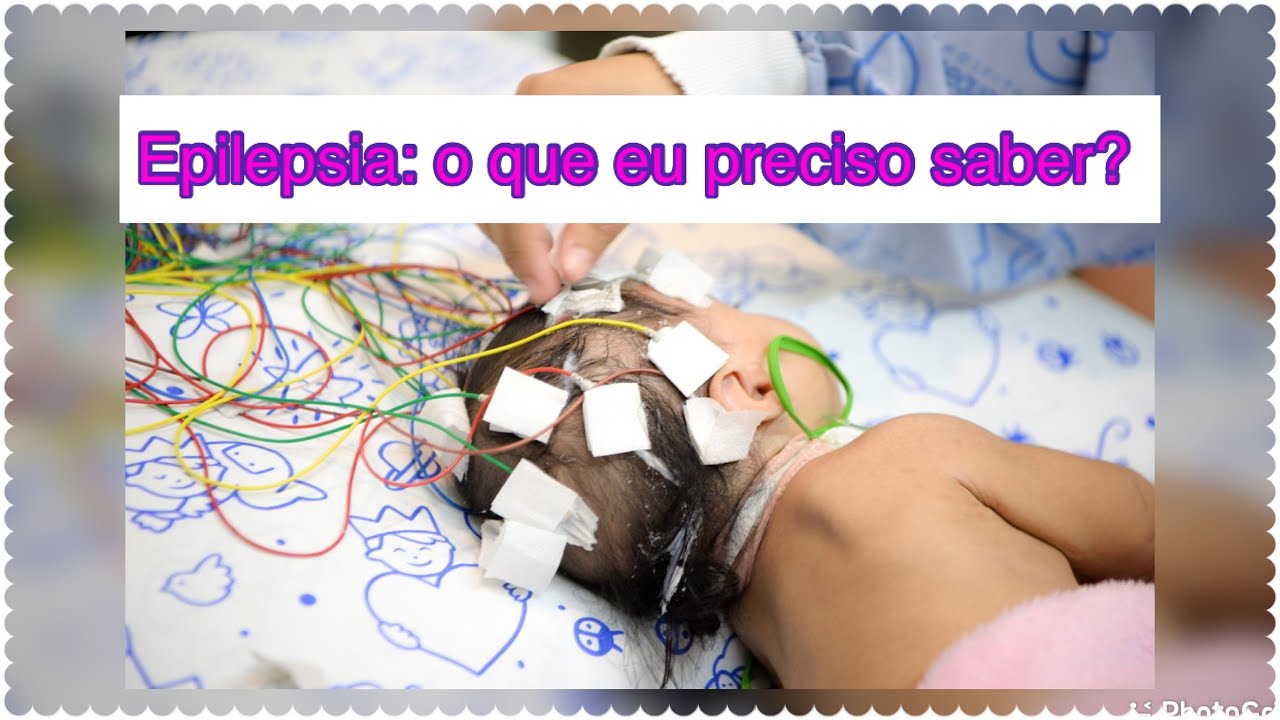 O que fazer durante uma crise epiléptica?